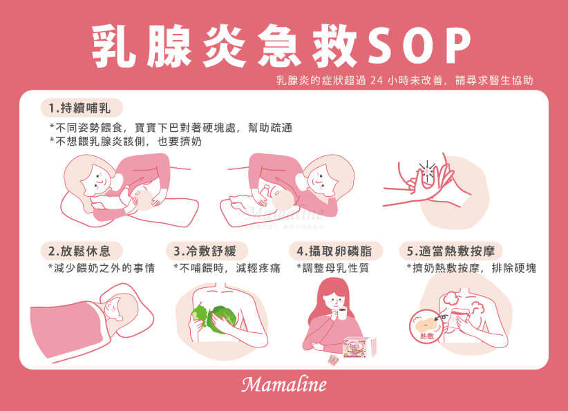 乳腺炎急救SOP-通乳腺方法