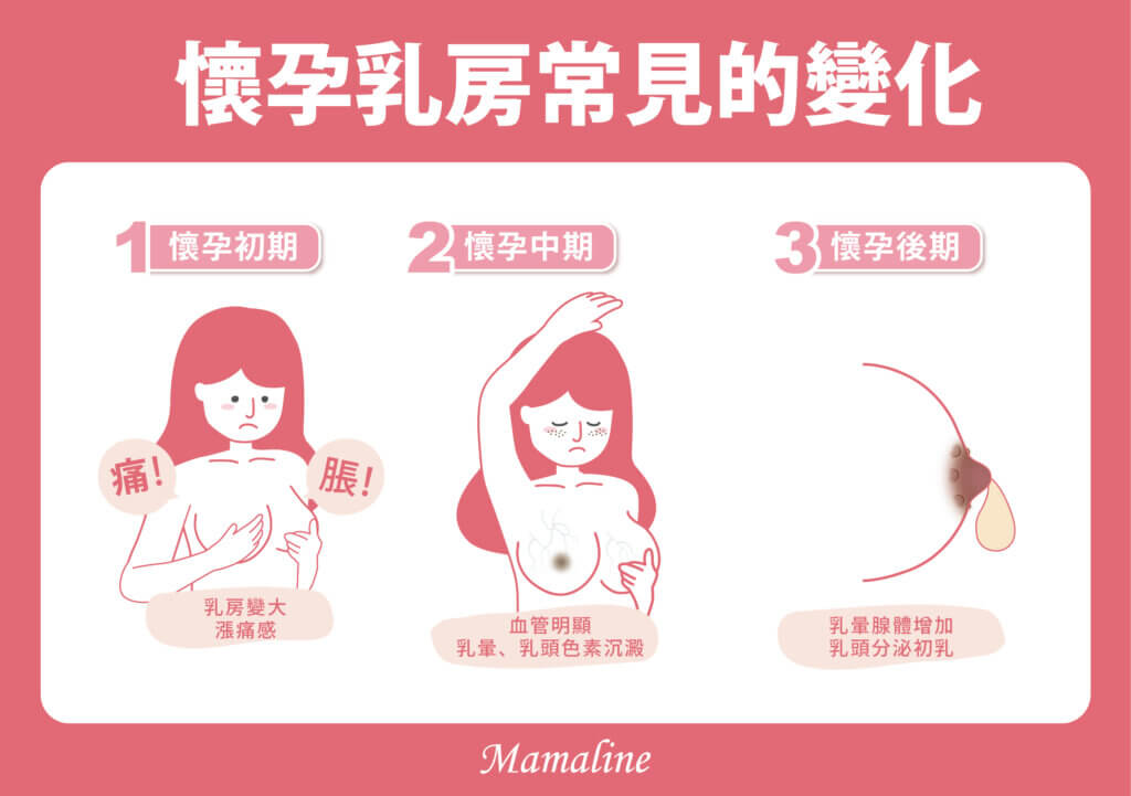 懷孕乳房常見的變化